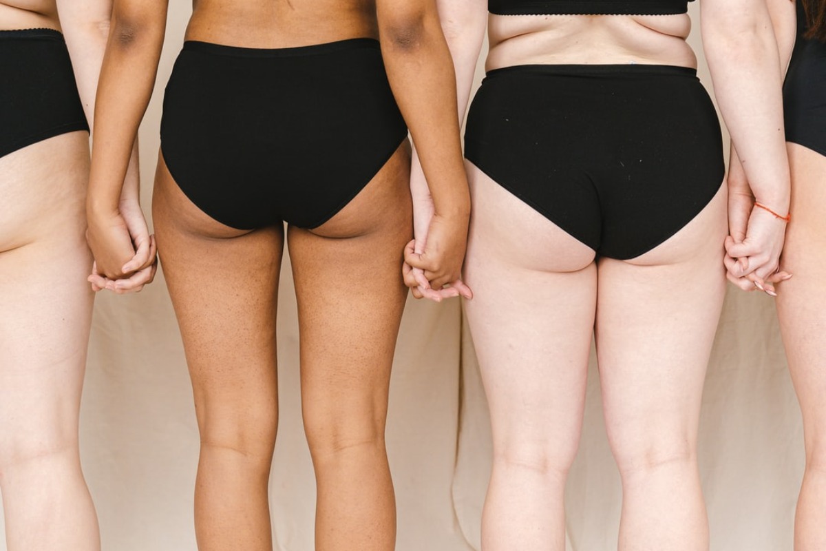 Titelbild zu „Lipödem oder Cellulite – worin liegt der Unterschied?“
