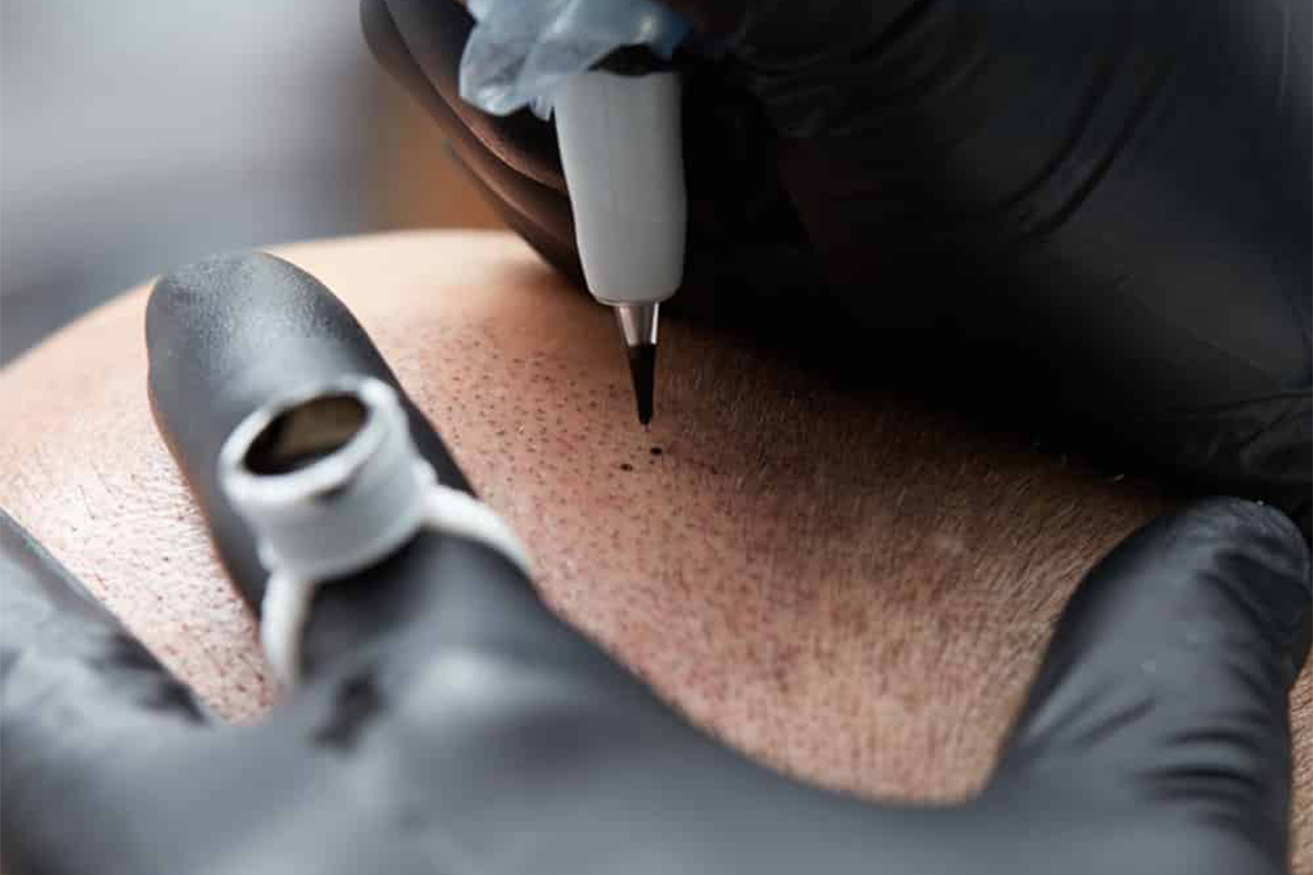Titelbild zu „Die Haarpigmentierung: innovative Lösung für ein großes Problem“