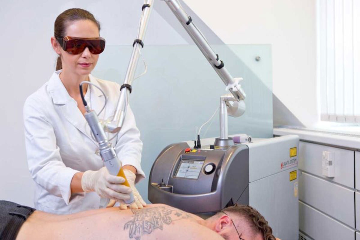 Titelbild zu „Tattooentfernung mit Laser die attraktivste Behandlungsmethode“